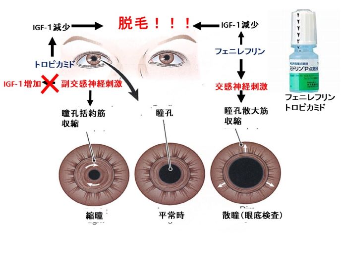 円形脱毛症　病院